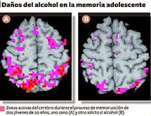 Las acciones de la codificación del alcohol