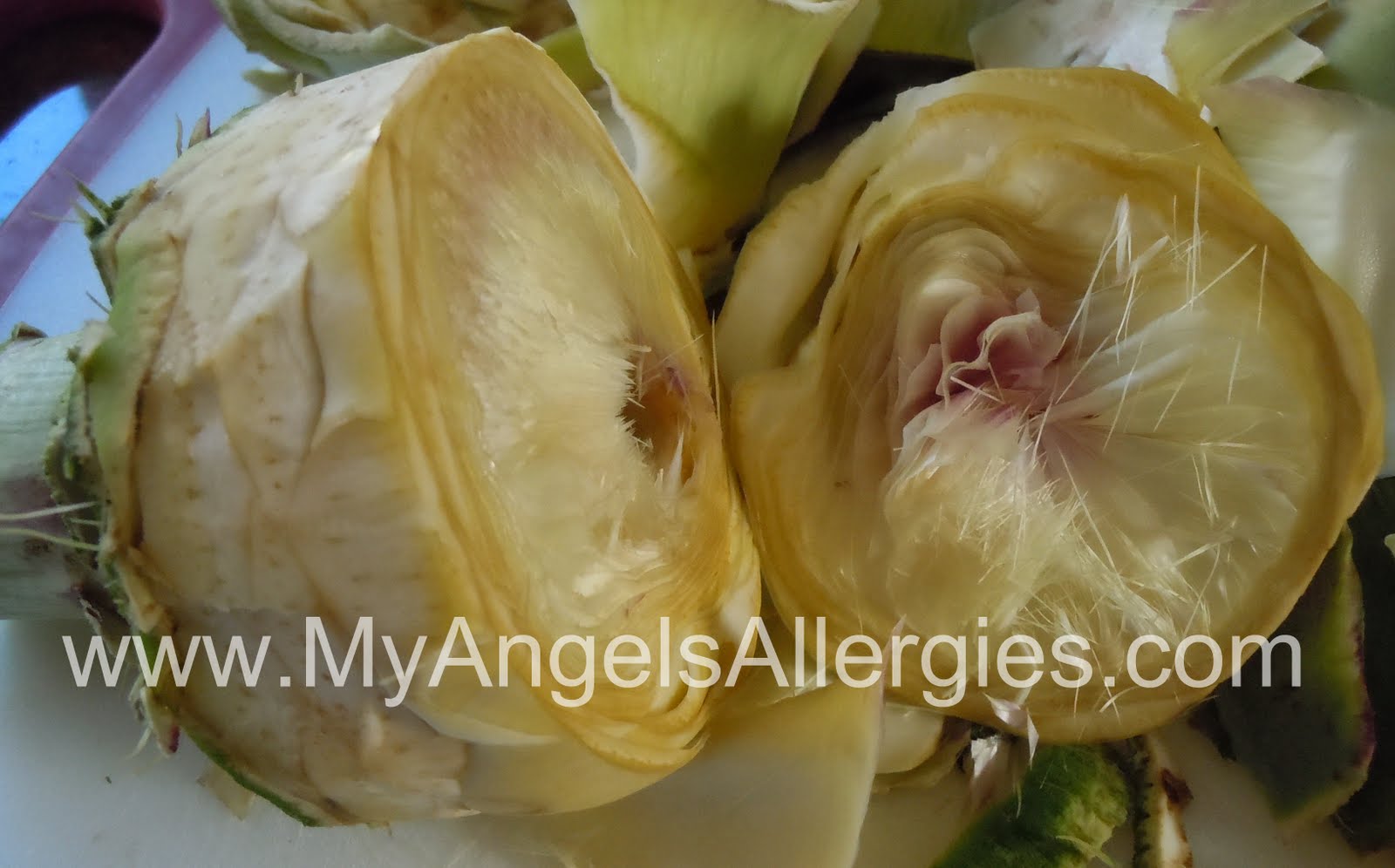 Artichokes The Heart My Angel's Allergies