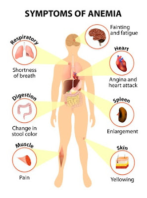 Watch Outside In: Iron-Deficiency Anemia video Watch Outside In: Iron-Deficiency Anemia video