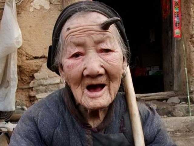 Estas son las imágenes más desagradables del mundo - Imagen 4