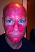 Tonight Was My Last Application On My Face Below My Eyes Tonight Was My Last Application On My Face Below My Eyes