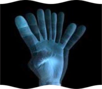 Pemeriksaan Klinis Neurologi: Diplopia..