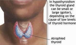 The Thyroid Gland The Thyroid Gland