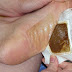 Make Detox Foot Pads at Home and Remove All the Dangerous Toxins from Your Body Overnight