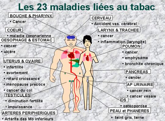 Sil y avoir être une température si cesser de fumer rudement