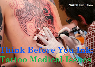 Tattoo Medical Issues Think Before You Ink: Tattoo Medical Issues