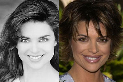 Lisa Rinna Before Lip Surgery