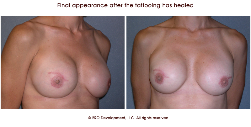 lindase.blogspot.comthe tattooing has healed