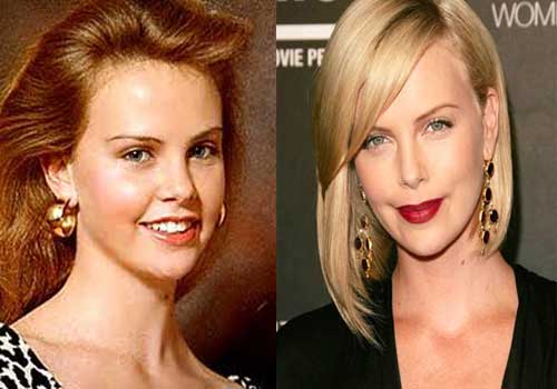 charlize theron plastic surgery