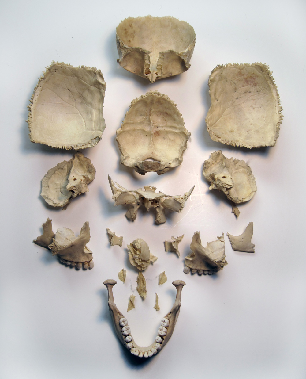 The Expressive Figure The Disarticulated Skull