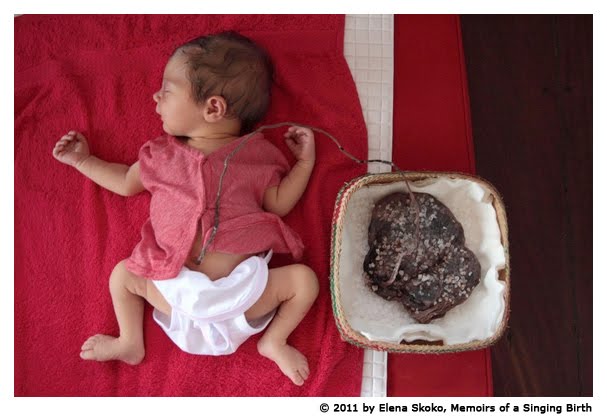 Taking Placenta Home From Hospital Taking Placenta Home From Hospital