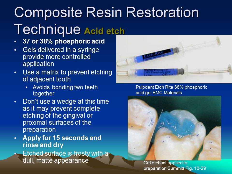 Dentistry Composite Resin