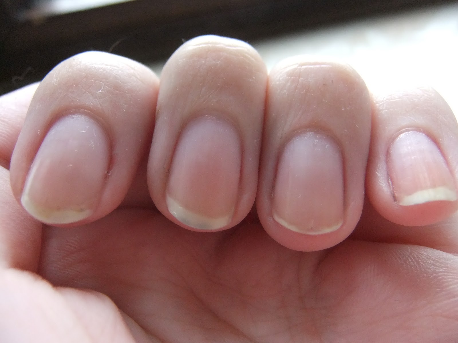 Nagelstudio Verband Empört Behörden Willkür So Reagiert Die Nagelstudio Szene - yq4i5fh