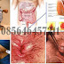 Alamat Pengobatan Herbal Wasir De Nature Indonesia thumbnail
