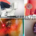 Ardium Obat Wasir Wanita Kena Ambeien thumbnail