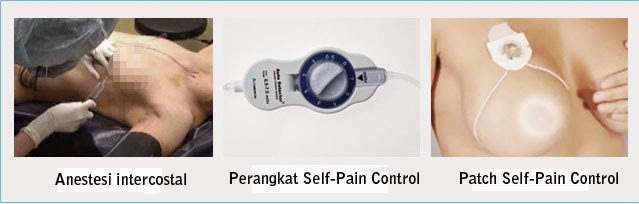 Sistem perawatan nyeri di rumah sakit bedah plastik Wonjin Sistem perawatan nyeri di rumah sakit bedah plastik Wonjin