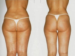 Dolore di vita e ragione forum di nausea