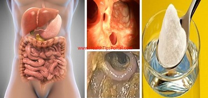 3 Días de colon, hígado y los pulmones de desintoxicación que eliminará todas las toxinas, grasa, el exceso de agua y limpiar arterias obstruidas 3-Días-de-colon-hígado-y-los-pulmones-de-desintoxicación-que-eliminará-todas-las-toxinas-grasa-el-exceso-de-agua-y-limpiar-arterias-obstruidas