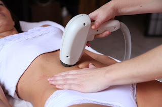 Radiofrecuencia en el abdomen