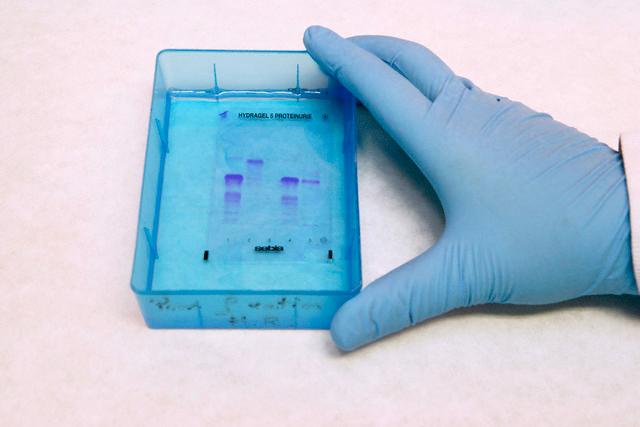 Unseen Rare Collection DNA Forensics,Kids,DNA Fragmentation