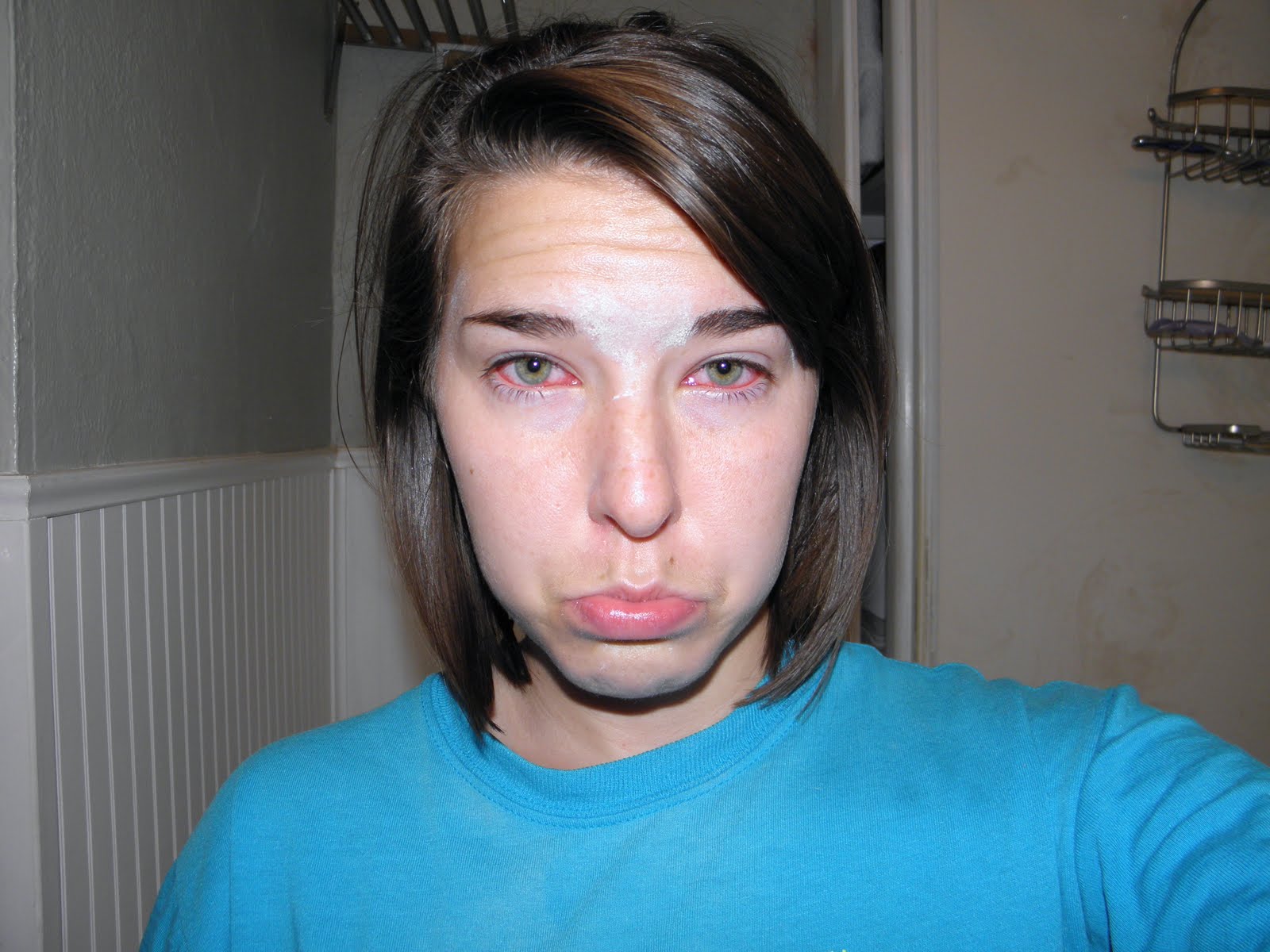 Eyes Matted Shut Baby at Adam Jennings blog