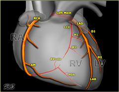 Heart Section