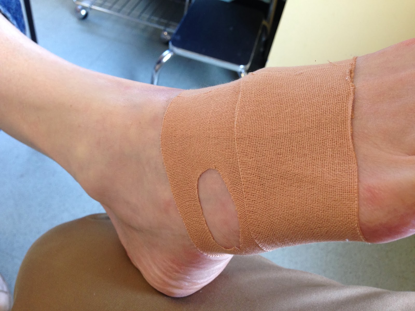 Foot and Ankle Problems By Dr. Richard Blake Sunday's Video of the