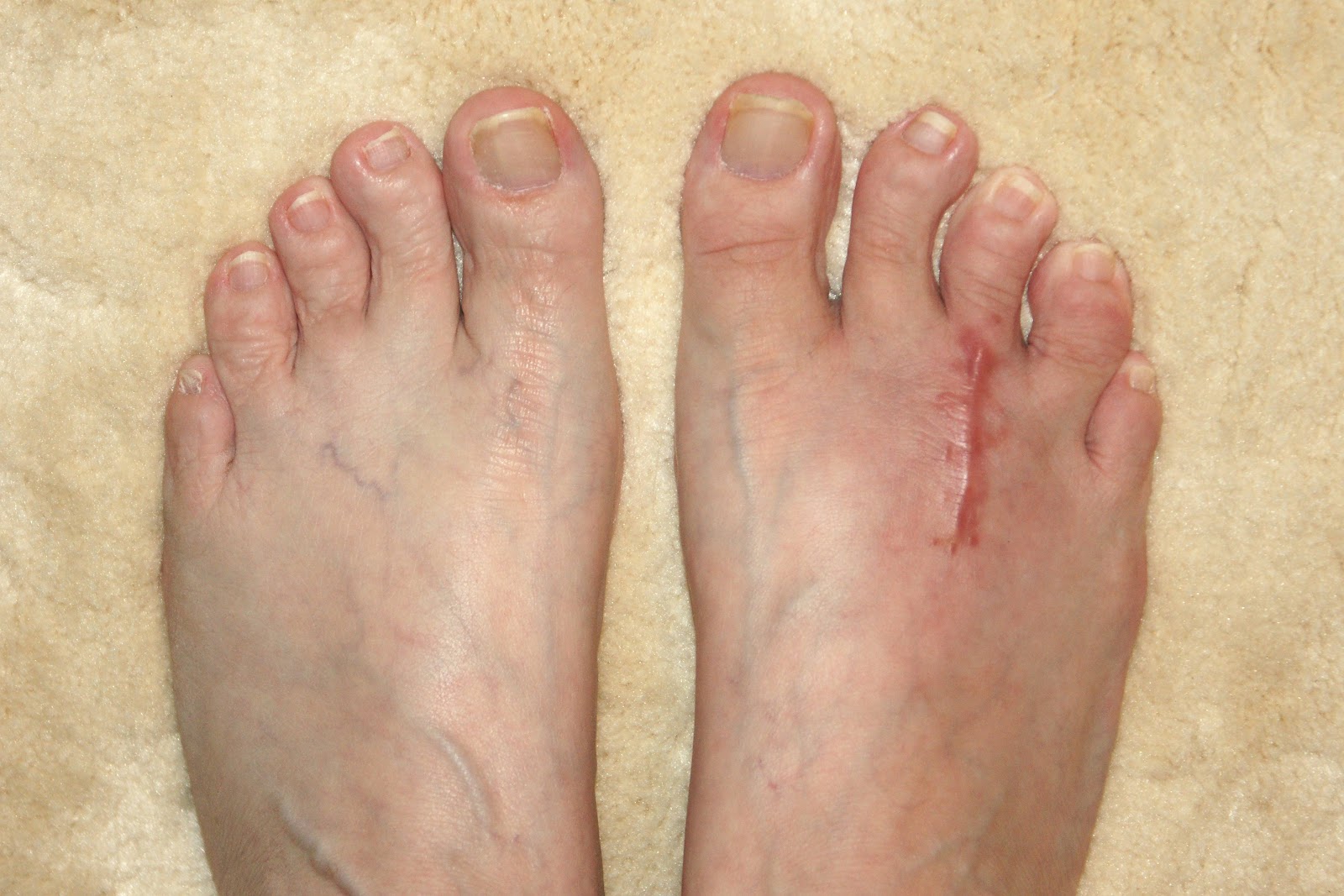 bearded-dragon-toe-swollen-2.jpg