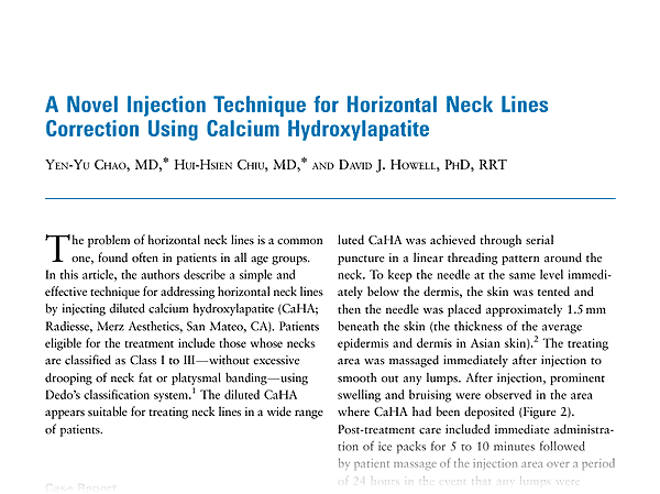 Radiesse for horizontal neck lines, dermatologic surgery, Yates Y. Chao Radiesse for horizontal neck lines, dermatologic surgery, Yates Y. Chao