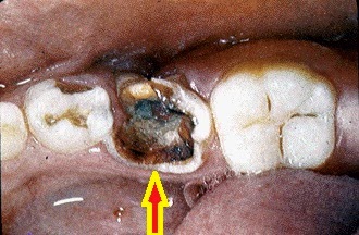 Info Kesehatan Indonesia: November 2014