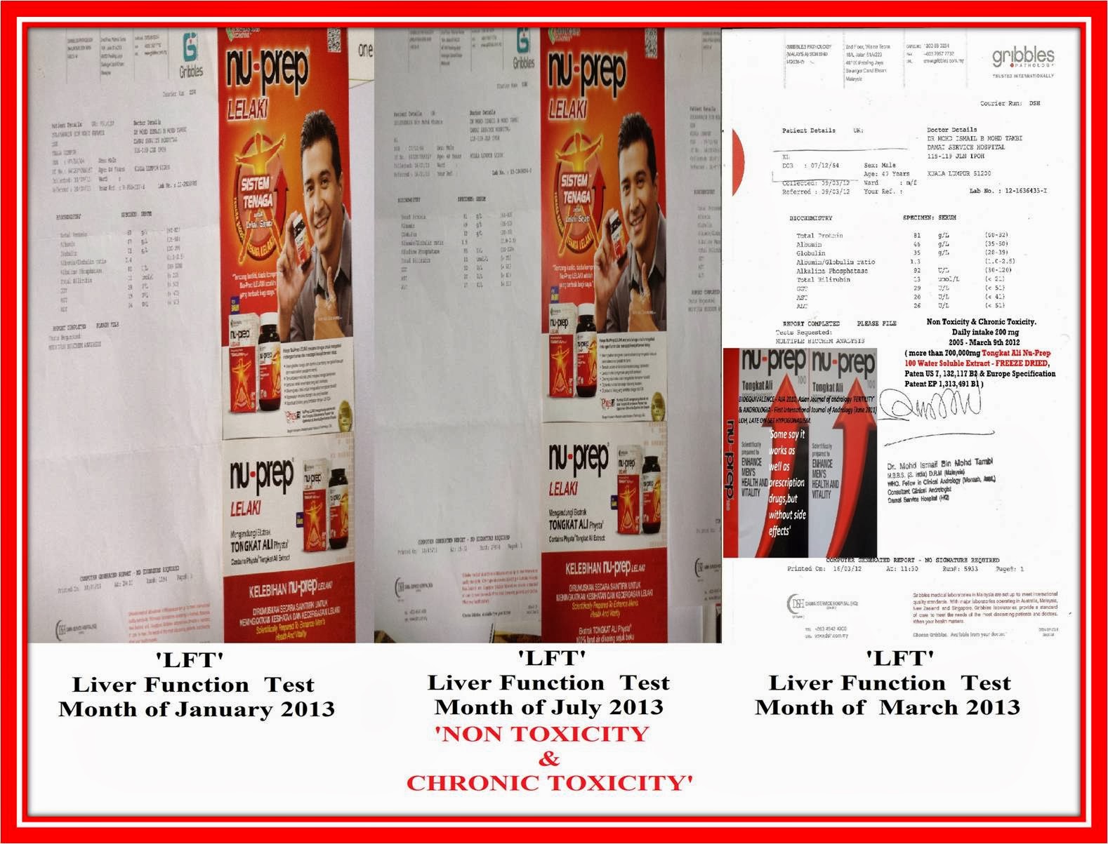 LFT Liver Function Test March 2012, January 2013 & July 2013 'Non Toxicity & Chronic Toxicity'