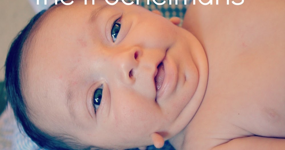 the trochelmans newborn skin tags