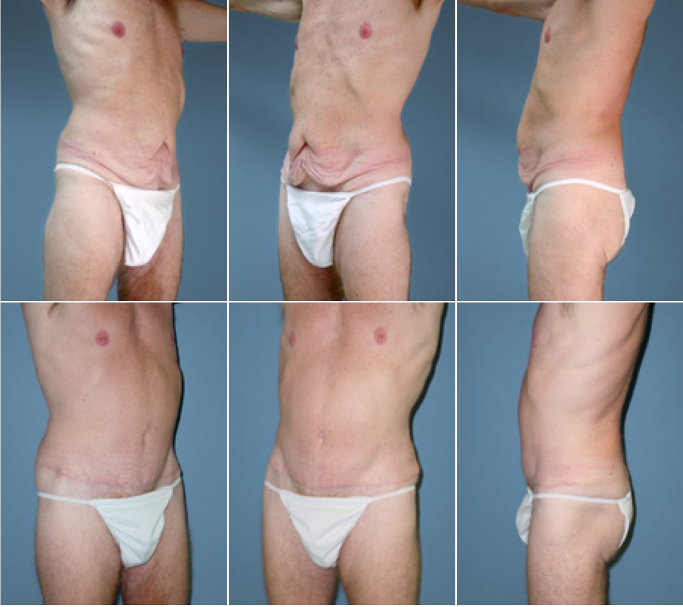 Every fat memorial weight loss clinic houston Water memorial weight loss clinic houston body composition measurements