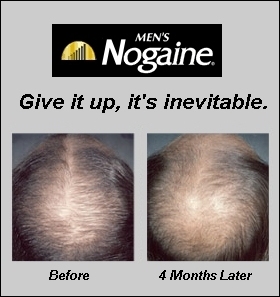 Rogaine 5