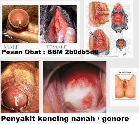 Ciprofloxacin and birth control patch Ciprofloxacin and birth control patch