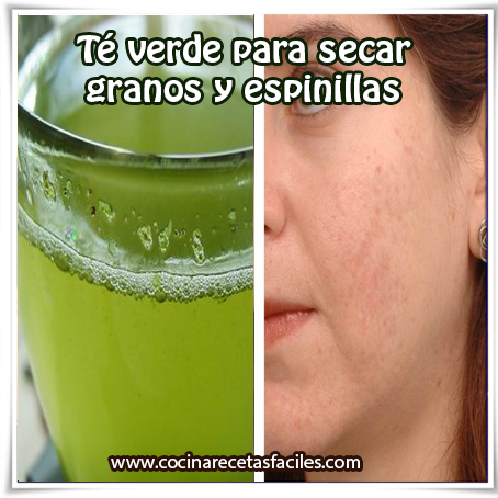 Té verde para secar granos y espinillas Belleza facial , cuidados del rostro, remedios caseros de té perder acné , granos , espinillas