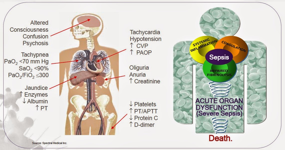 EDT.TO Spectral Medical Preparing To Release Key Sepsis Data Later