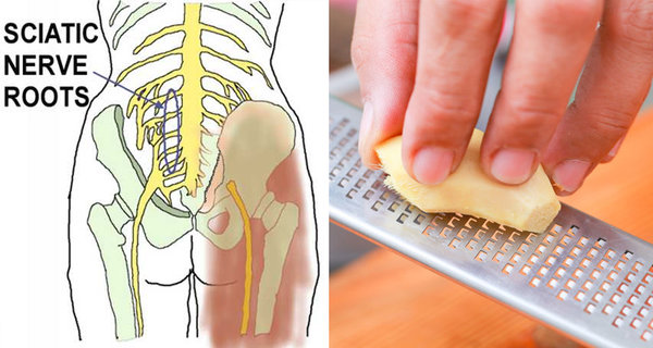 Treat Sciatica Pain Without Medicine (use herbs from your pantry instead) Treat Sciatica Pain Without Medicine (use herbs from your pantry instead)