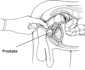 see sexy prostitutes fucking prostate from inside your anus