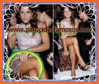 Priscila Fantin Priscila Fantin celulitis