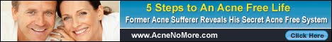 5 Step to An Acne Free Life