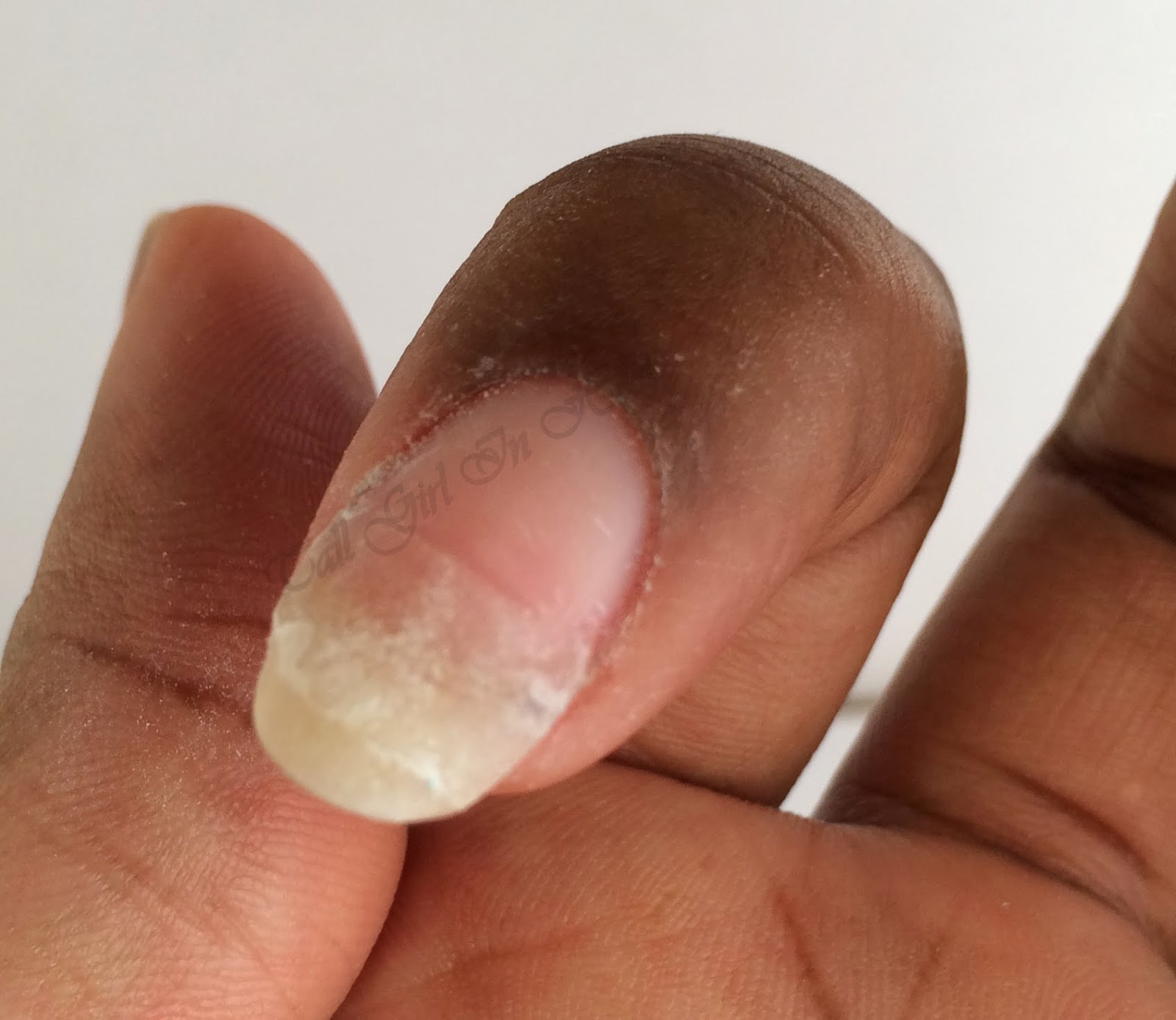 broken nail repair