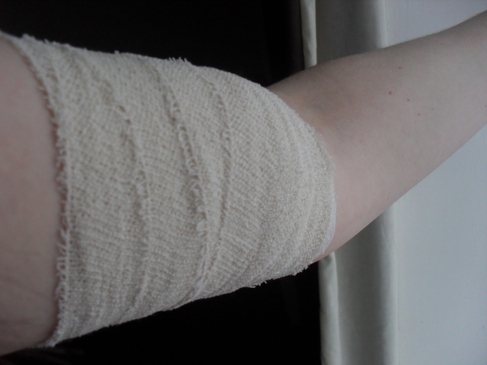 My experience with Nexplanon (contraceptive implant)