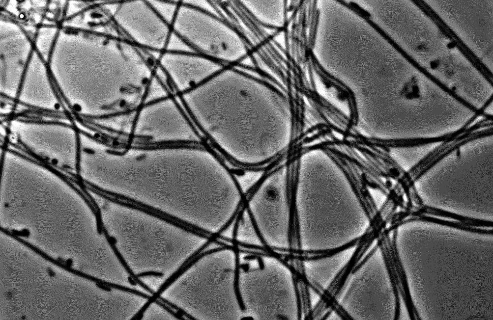 Of Bacteria and Men Bacteria in a wastewater treatment plant