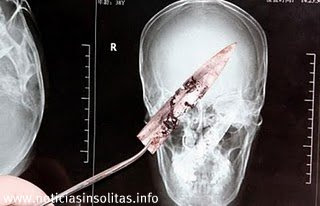 cuchillo cabeza vivio