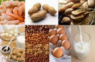 5 Makanan Ini Memperburuk Jerawat