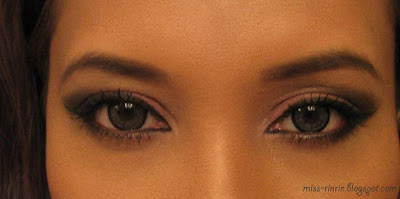 Why Is My Limbal Ring Thicker Why Is My Limbal Ring Thicker