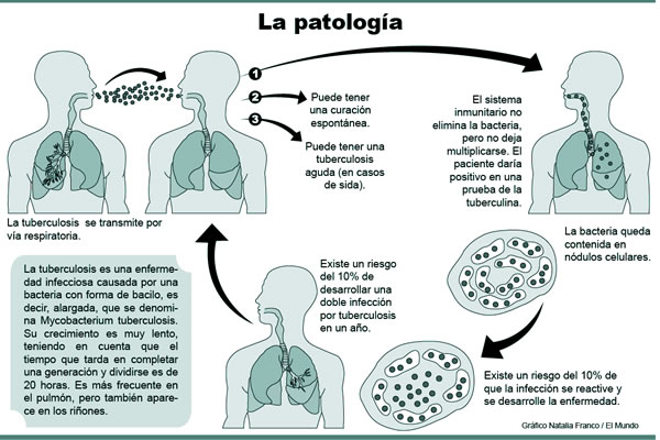 cadena epidemiologica poliomelitis tuberculosis agosto 2013 cadena epidemiologica poliomelitis tuberculosis agosto 2013