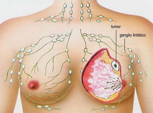 EL PROCESO SALUD Y ENFERMEDAD el proceso salud y enfermedad: