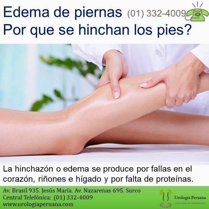 La crema para los pies de varikoza el foro